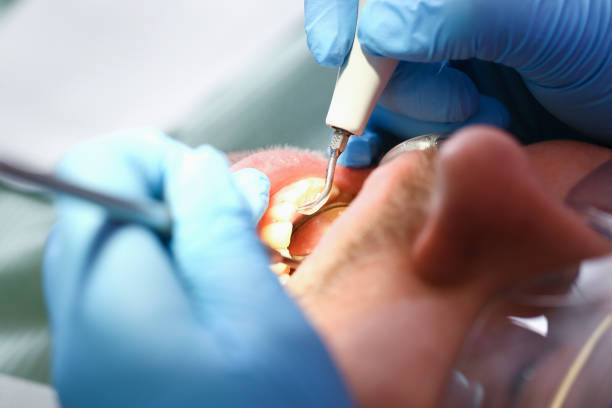 Best Emergency Denture Repair in Rockvale, TN